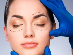Blefaroplastia